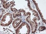 LCMT1 Antibody in Immunohistochemistry (Paraffin) (IHC (P))