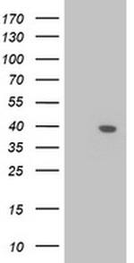 LCMT1 Antibody in Western Blot (WB)