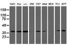 LCMT1 Antibody in Western Blot (WB)