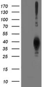 LCMT1 Antibody in Western Blot (WB)