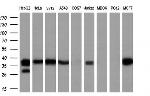 LCMT1 Antibody in Western Blot (WB)