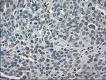 LDHA Antibody in Immunohistochemistry (Paraffin) (IHC (P))