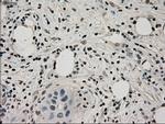 LDHA Antibody in Immunohistochemistry (Paraffin) (IHC (P))