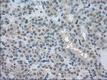 LDHA Antibody in Immunohistochemistry (Paraffin) (IHC (P))