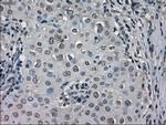 LDHA Antibody in Immunohistochemistry (Paraffin) (IHC (P))