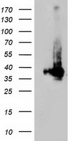 LDLRAP1 Antibody in Western Blot (WB)