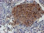 LECT2 Antibody in Immunohistochemistry (Paraffin) (IHC (P))