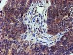 LECT2 Antibody in Immunohistochemistry (Paraffin) (IHC (P))