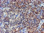 LECT2 Antibody in Immunohistochemistry (Paraffin) (IHC (P))