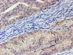 LECT2 Antibody in Immunohistochemistry (Paraffin) (IHC (P))