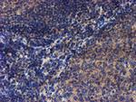 LECT2 Antibody in Immunohistochemistry (Paraffin) (IHC (P))