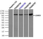 LEMD3 Antibody in Immunoprecipitation (IP)