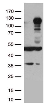 LEMD3 Antibody in Western Blot (WB)