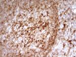 LGALS9 Antibody in Immunohistochemistry (Paraffin) (IHC (P))