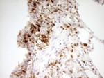 LGALS9 Antibody in Immunohistochemistry (Paraffin) (IHC (P))