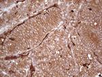 LGALS9 Antibody in Immunohistochemistry (Paraffin) (IHC (P))