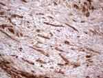 LGALS9 Antibody in Immunohistochemistry (Paraffin) (IHC (P))