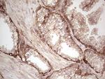 LGALS9 Antibody in Immunohistochemistry (Paraffin) (IHC (P))