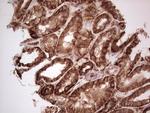 LGALS9 Antibody in Immunohistochemistry (Paraffin) (IHC (P))