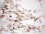 LGALS9 Antibody in Immunohistochemistry (Paraffin) (IHC (P))