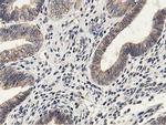 LGR5 Antibody in Immunohistochemistry (Paraffin) (IHC (P))