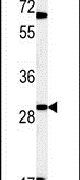 LHFPL2 Antibody in Western Blot (WB)