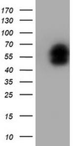 LHX1 Antibody in Western Blot (WB)