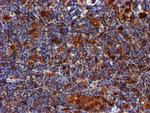 LIMK1 Antibody in Immunohistochemistry (Paraffin) (IHC (P))