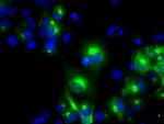 LIPG Antibody in Immunocytochemistry (ICC/IF)