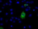 LIPG Antibody in Immunocytochemistry (ICC/IF)