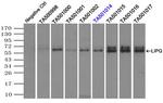 LIPG Antibody in Immunoprecipitation (IP)