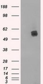 LIPG Antibody in Western Blot (WB)