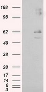 LIPG Antibody in Western Blot (WB)