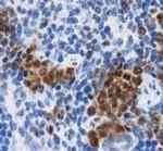 LOX Antibody in Immunohistochemistry (IHC)