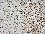 LOX Antibody in Immunohistochemistry (Paraffin) (IHC (P))