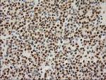 LOX Antibody in Immunohistochemistry (Paraffin) (IHC (P))