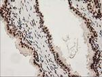 LOX Antibody in Immunohistochemistry (Paraffin) (IHC (P))