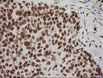 LOX Antibody in Immunohistochemistry (Paraffin) (IHC (P))