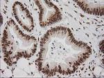 LOX Antibody in Immunohistochemistry (Paraffin) (IHC (P))