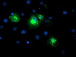 LPAR1 Antibody in Immunocytochemistry (ICC/IF)