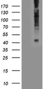 LPAR1 Antibody in Western Blot (WB)