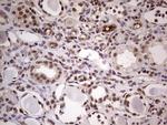 LPIN1 Antibody in Immunohistochemistry (Paraffin) (IHC (P))