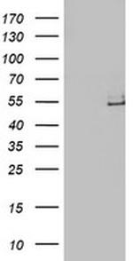 LPL Antibody in Western Blot (WB)