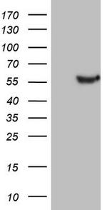 LRRC6 Antibody in Western Blot (WB)