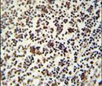 LSP1 Antibody in Immunohistochemistry (IHC)