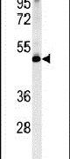 LSP1 Antibody in Western Blot (WB)