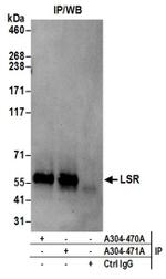 LSR Antibody in Immunoprecipitation (IP)
