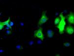 LTA4H Antibody in Immunocytochemistry (ICC/IF)