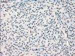 LTA4H Antibody in Immunohistochemistry (Paraffin) (IHC (P))