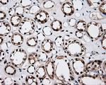 LTA4H Antibody in Immunohistochemistry (Paraffin) (IHC (P))